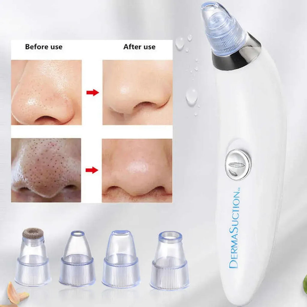 Rechargeable 5-in-1 Derma Suction Blackhead Remover & Pore Vacuum